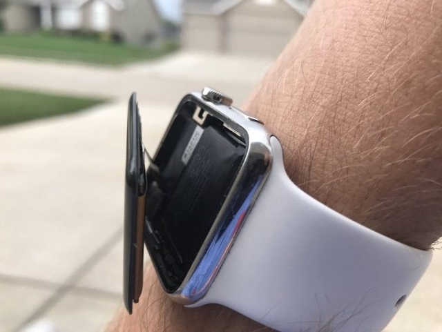 Жительница США подала в суд на Apple из-за вздувшейся батареи в Apple Watch